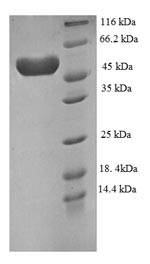 Recombinant Human Plexin-A4 (PLXNA4), partial – Figure 1 of 1