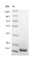 (Tris-Glycine gel) Discontinuous SDS-PAGE (reduced) with 5% enrichment gel and 15% separation gel.
