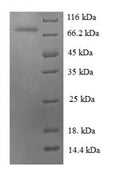 Recombinant Human Heat shock 70 kDa protein 6 (HSPA6), partial – Figure 1 of 1