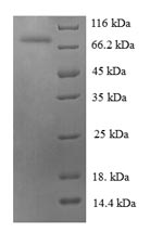 Recombinant Human Heat shock 70 kDa protein 6 (HSPA6), partial – Figure 1 of 1