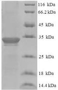 Recombinant Human Dysbindin domain-containing protein 2 (DBNDD2) – Figure 1 of 1