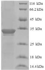 Recombinant Human Dysbindin domain-containing protein 2 (DBNDD2) – Figure 1 of 1
