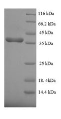Recombinant Human Dual specificity protein phosphatase 26 (DUSP26) – Figure 1 of 1