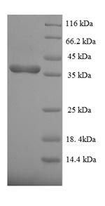 Recombinant Human Dual specificity protein phosphatase 26 (DUSP26) – Figure 1 of 1