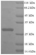 Recombinant Human 39S ribosomal protein L20, mitochondrial (MRPL20), partial – Figure 1 of 1