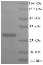 Recombinant Human 39S ribosomal protein L20, mitochondrial (MRPL20), partial – Figure 1 of 1
