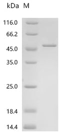 (Tris-Glycine gel) Discontinuous SDS-PAGE (reduced) with 5% enrichment gel and 15% separation gel.