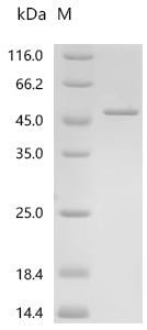 (Tris-Glycine gel) Discontinuous SDS-PAGE (reduced) with 5% enrichment gel and 15% separation gel.