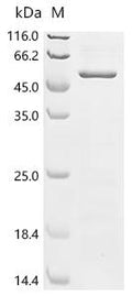 (Tris-Glycine gel) Discontinuous SDS-PAGE (reduced) with 5% enrichment gel and 15% separation gel.