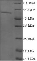Recombinant Human Exonuclease V (EXO5) – Figure 1 of 1