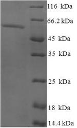 Recombinant Human Exonuclease V (EXO5) – Figure 1 of 1