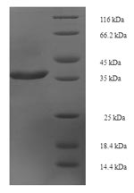 Recombinant Human Rab-like protein 5 (RABL5) – Figure 1 of 1