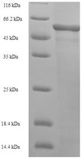 Recombinant Human L-2-hydroxyglutarate dehydrogenase, mitochondrial (L2HGDH) – Figure 1 of 1