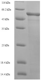 Recombinant Human L-2-hydroxyglutarate dehydrogenase, mitochondrial (L2HGDH) – Figure 1 of 1