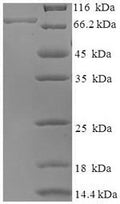 Recombinant Mouse BAG family molecular chaperone regulator 3 (Bag3) – Figure 1 of 1