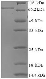 Recombinant Mouse BAG family molecular chaperone regulator 3 (Bag3) – Figure 1 of 1