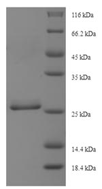 Recombinant Human Dynein light chain roadblock-type 1 (DYNLRB1), partial – Figure 1 of 1