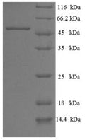 Recombinant Human L-aminoadipate-semialdehyde dehydrogenase-phosphopantetheinyl transferase (AASDHPPT) – Figure 1 of 1