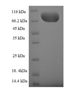 Recombinant Human Guanine nucleotide-binding protein-like 3-like protein (GNL3L) – Figure 1 of 1