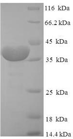 Recombinant Human Peptidyl-prolyl cis-trans isomerase FKBP14 (FKBP14) – Figure 1 of 1