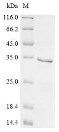 (Tris-Glycine gel) Discontinuous SDS-PAGE (reduced) with 5% enrichment gel and 15% separation gel.