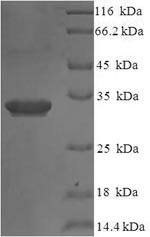 Recombinant Human Interleukin-36 receptor antagonist protein (IL36RN) – Figure 1 of 1