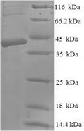 Recombinant Human Dickkopf-related protein 2 (DKK2) – Figure 1 of 1