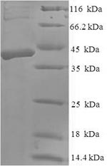 Recombinant Human Dickkopf-related protein 2 (DKK2) – Figure 1 of 1