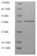 Recombinant Human Zinc finger matrin-type protein 5 (ZMAT5) – Figure 1 of 1