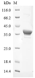 (Tris-Glycine gel) Discontinuous SDS-PAGE (reduced) with 5% enrichment gel and 15% separation gel.