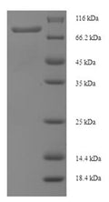 Recombinant Human 1-phosphatidylinositol 4,5-bisphosphate phosphodiesterase delta-4 (PLCD4) – Figure 1 of 1