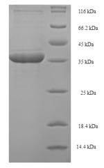 Recombinant Human Phospholysine phosphohistidine inorganic pyrophosphate phosphatase (LHPP) – Figure 1 of 1
