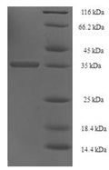 Recombinant Human UPF0454 protein C12orf49 (C12orf49) – Figure 1 of 1