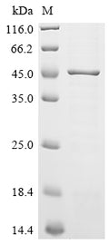 (Tris-Glycine gel) Discontinuous SDS-PAGE (reduced) with 5% enrichment gel and 15% separation gel.