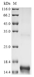 (Tris-Glycine gel) Discontinuous SDS-PAGE (reduced) with 5% enrichment gel and 15% separation gel.