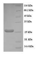 Recombinant Human Neuritin (NRN1) – Figure 1 of 1