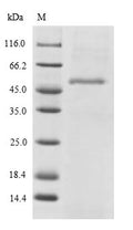 Recombinant Human Endophilin-B2 (SH3GLB2) – Figure 1 of 1