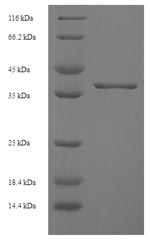 Recombinant Human Ankyrin repeat and SOCS box protein 6 (ASB6) – Figure 1 of 1