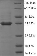 Recombinant Human Glutaminyl-peptide cyclotransferase-like protein (QPCTL), partial – Figure 1 of 1