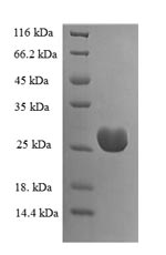 Recombinant Human Uncharacterized protein KIAA1377 (KIAA1377), partial – Figure 1 of 1