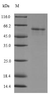 Recombinant Human [Pyruvate dehydrogenase [acetyl-transferring]]-phosphatase 2, mitochondrial (PDP2) – Figure 1 of 1