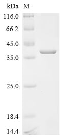 (Tris-Glycine gel) Discontinuous SDS-PAGE (reduced) with 5% enrichment gel and 15% separation gel.