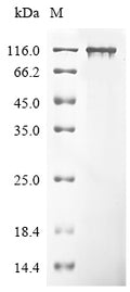 (Tris-Glycine gel) Discontinuous SDS-PAGE (reduced) with 5% enrichment gel and 15% separation gel.