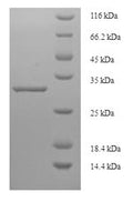 (Tris-Glycine gel) Discontinuous SDS-PAGE (reduced) with 5% enrichment gel and 15% separation gel.