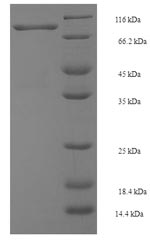 Recombinant Human E3 ubiquitin-protein ligase SMURF2 (SMURF2) – Figure 1 of 1