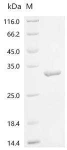 (Tris-Glycine gel) Discontinuous SDS-PAGE (reduced) with 5% enrichment gel and 15% separation gel.