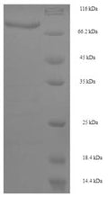 Recombinant Human Cytochrome P450 4F11 (CYP4F11), partial – Figure 1 of 1