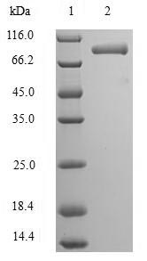Recombinant Human Ribonucleoprotein PTB-binding 2 (RAVER2) – Figure 1 of 1