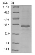 (Tris-Glycine gel) Discontinuous SDS-PAGE (reduced) with 5% enrichment gel and 15% separation gel.