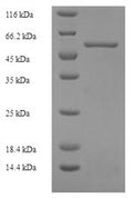 Recombinant Human CYFIP-related Rac1 interactor B (CYRIB) – Figure 1 of 1